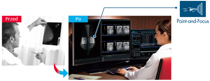 EIZO RadiForce RX560